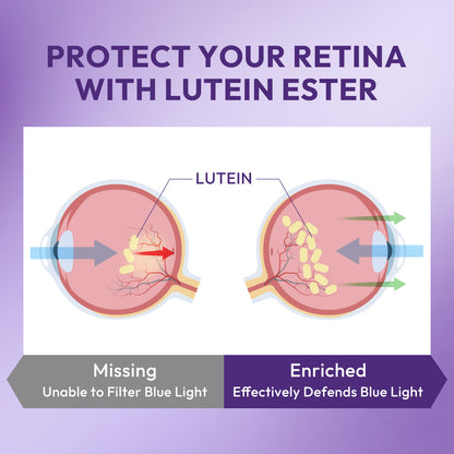 Lutein Ester Gummies for Eye Health
